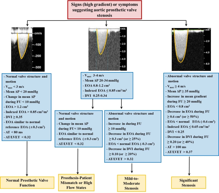 Prosthetic heart valves Part 4 Complications and dysfunction, pregnancy